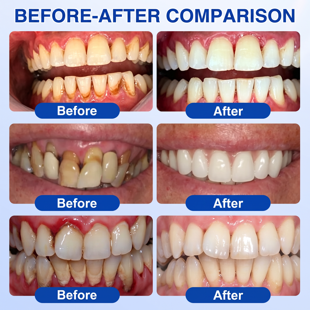 🦷Solaroza® GumRevive periodontal repair gel💧
