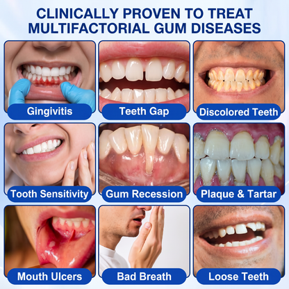 🦷Solaroza® GumRevive periodontal repair gel💧