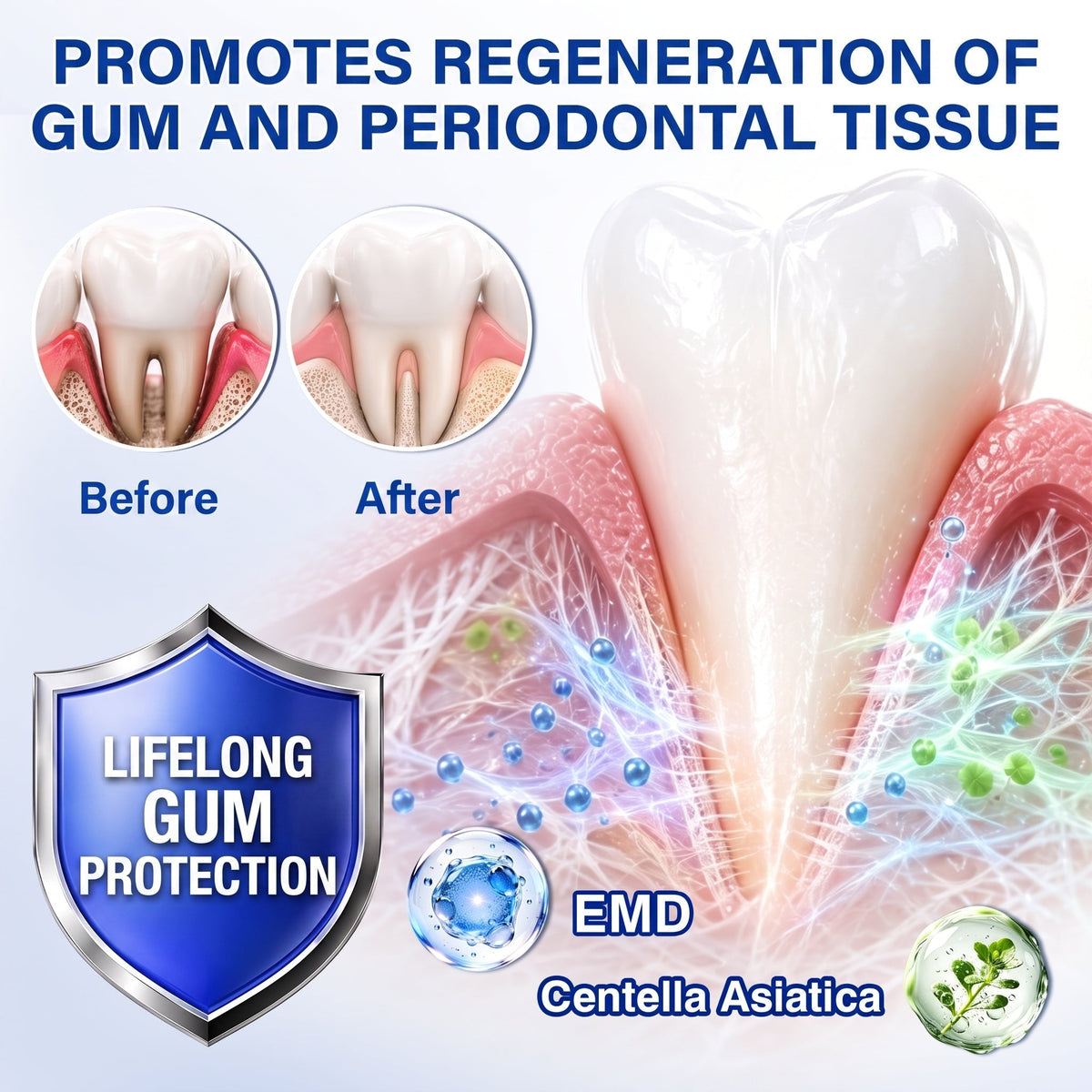 🦷Solaroza® GumRevive periodontal repair gel💧