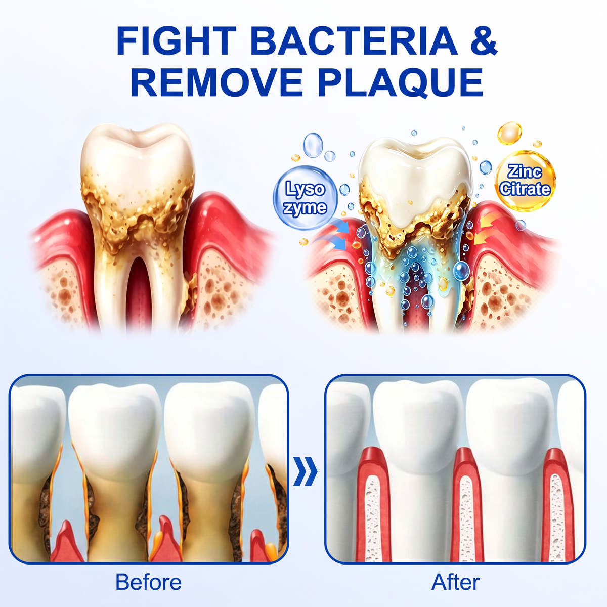 🦷Solaroza® GumRevive periodontal repair gel💧