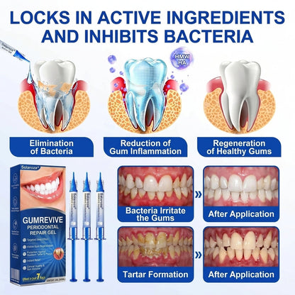 🦷Solaroza® GumRevive periodontal repair gel💧